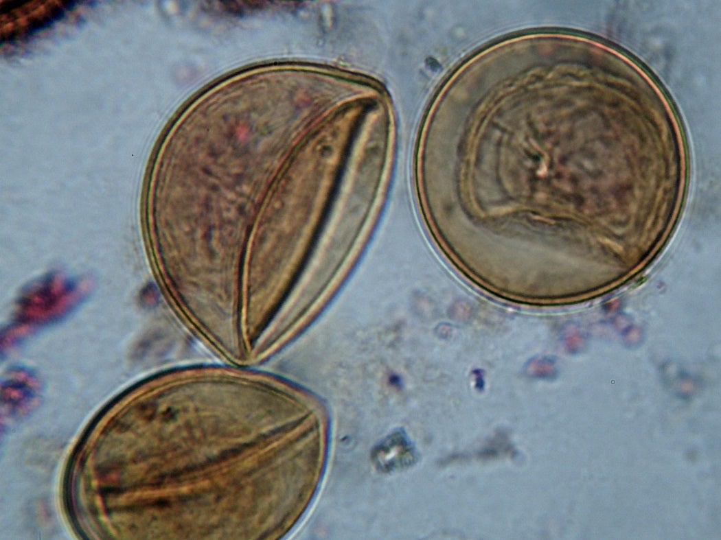 Microscope view of three tapeworm eggs