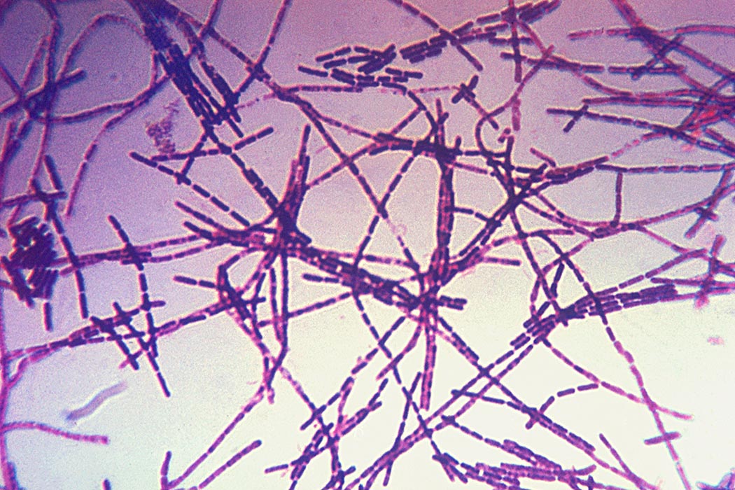 Microscope view of anthrax