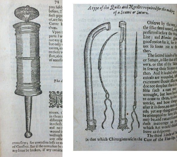 First Blood Transfusion: A History - JSTOR Daily