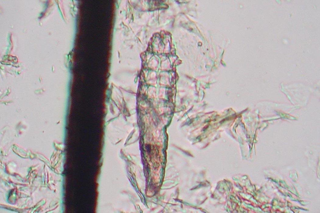 Demodex canis