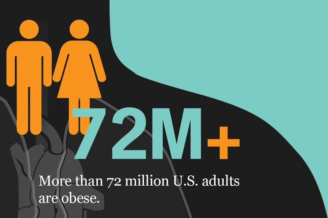 Graphic reading that more than 72 million U.S. adults are obese