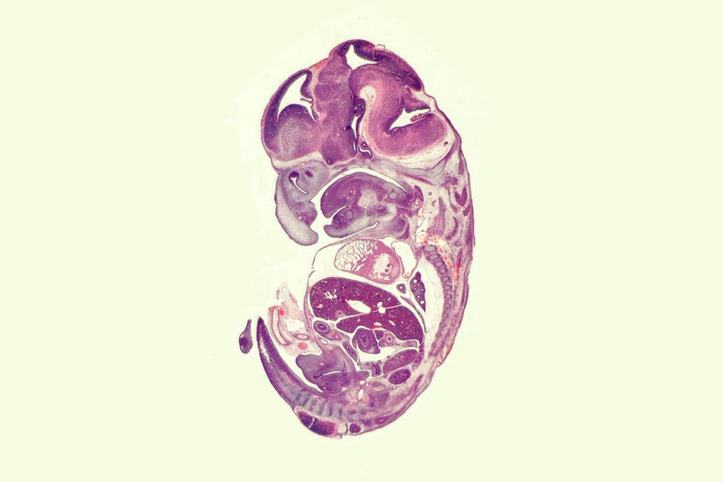 Mouse embryo