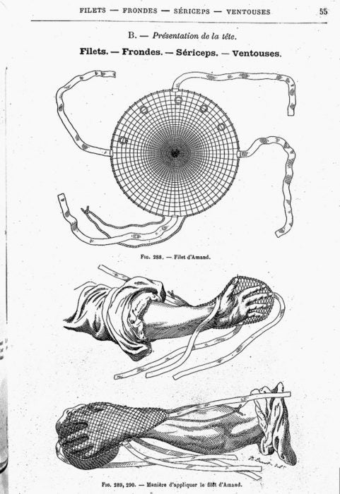 Obstetrical instruments, 1887