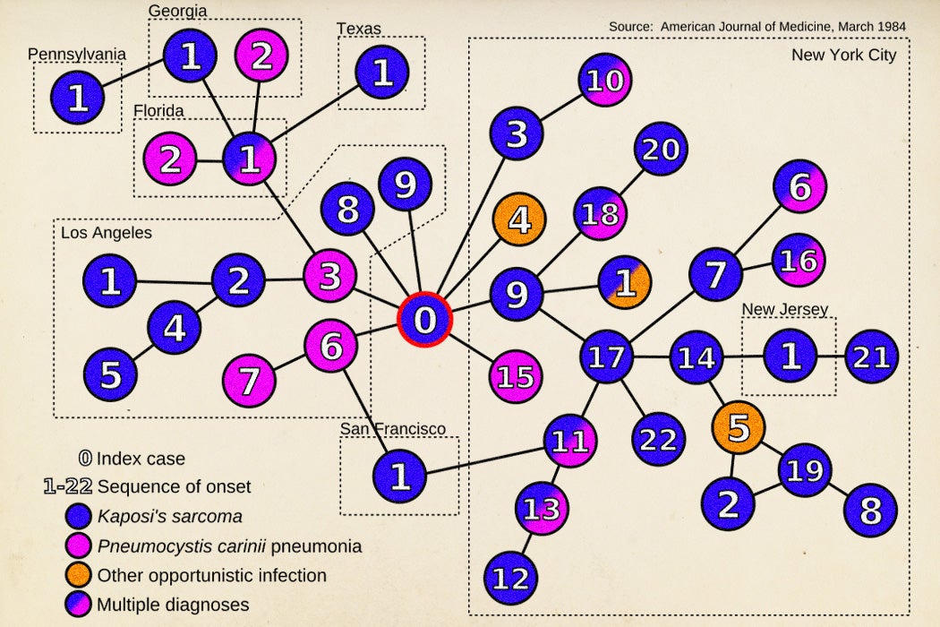 A graph of the early onset of AIDS from the alleged index case of Gaëtan Dugas aka 