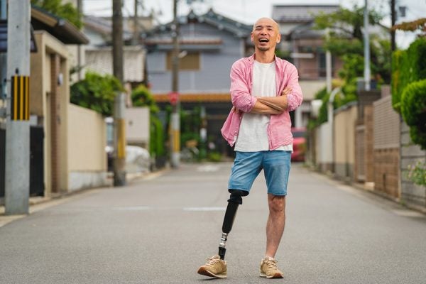 A man with a prosthetic leg