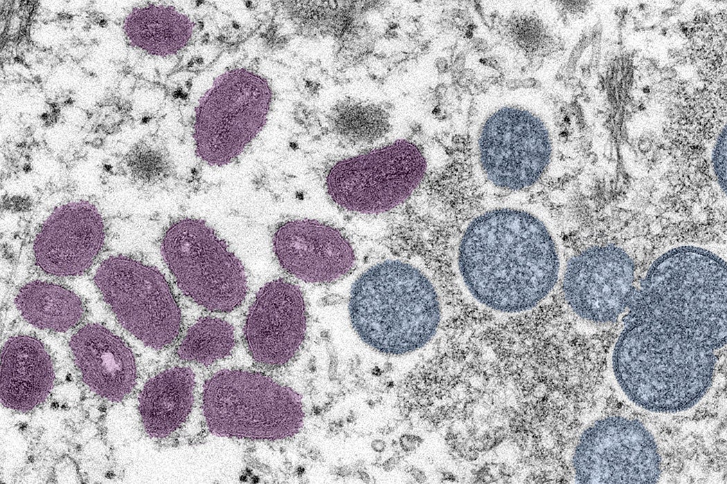 An electron microscopic image depicting a monkeypox virion