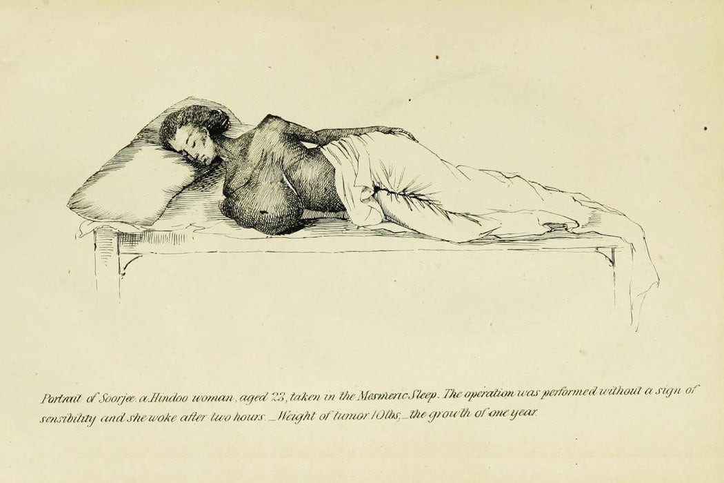Illustration from The Introduction of Mesmerism into the Public Hospitals of India