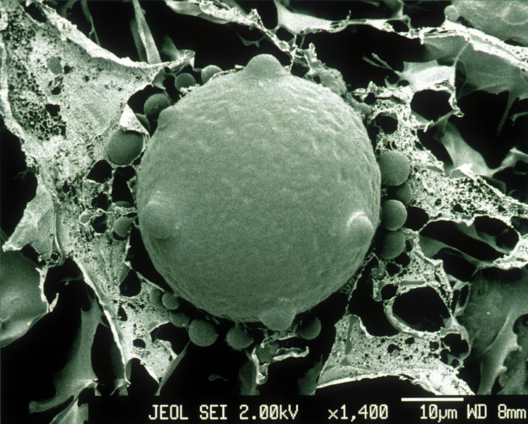 Electron Micrograph of Chytrid Fungus