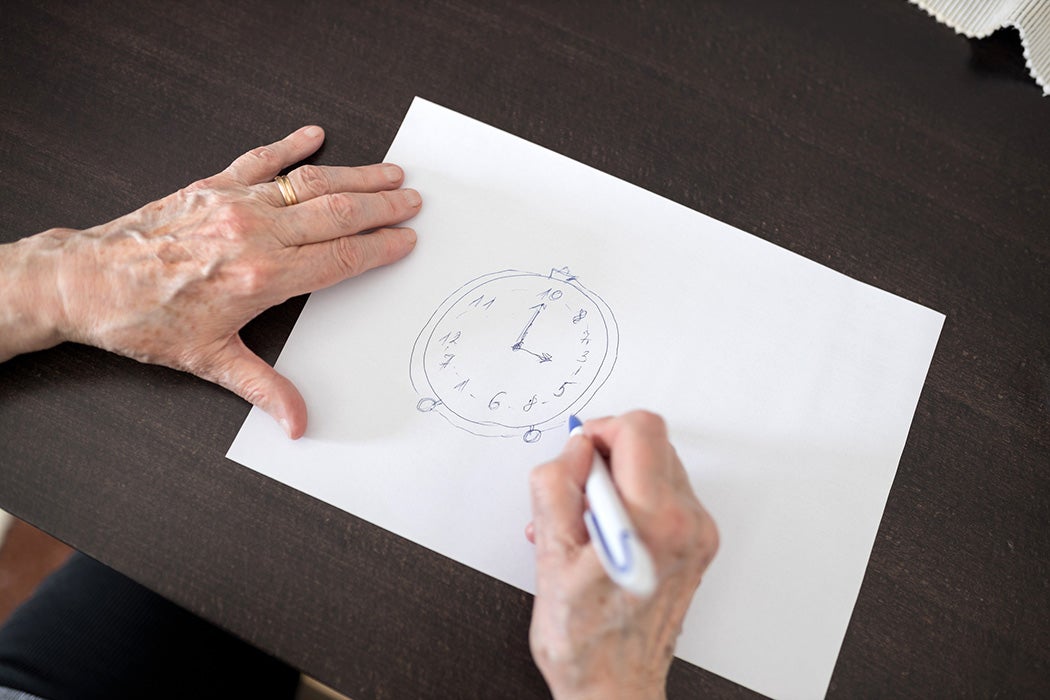 High angle close-up view of a senior Caucasian woman's hands drawing Alzheimer's disease cognitive functions clock test with positive results suggesting illness