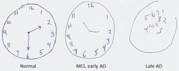 A clock drawing task
