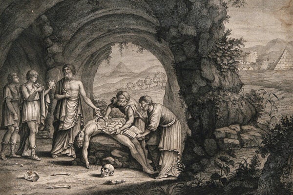 A scene of anatomical dissection in the ancient world