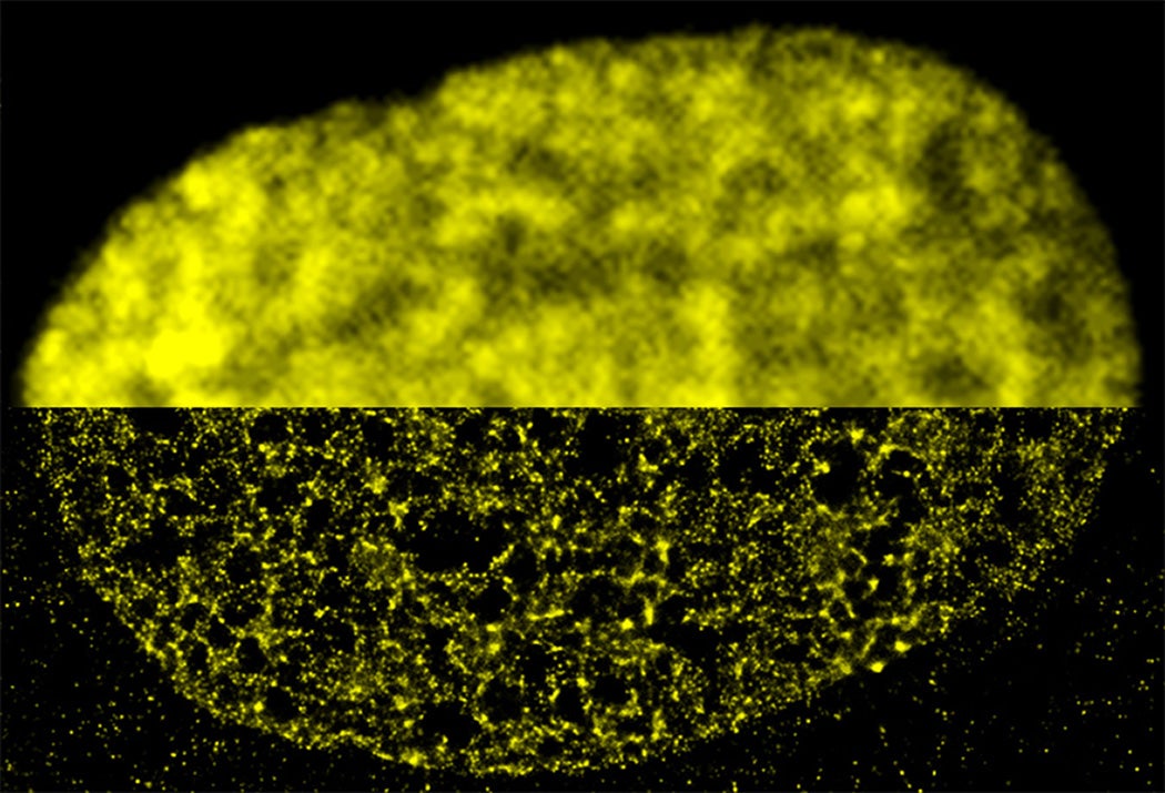 Within a fibroblast cell nucleus, the DNA-binding histone protein called H2B is fluorescently labeled in yellow. The top half was imaged with conventional wide-field fluorescence microscopy; the bottom half was imaged with super-resolution microscopy.