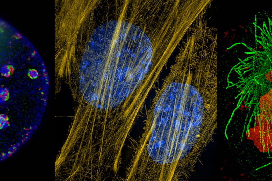 At center, the cytoskeleton’s actin fibers in mouse connective tissue cells are seen in yellow; cellular DNA is stained blue