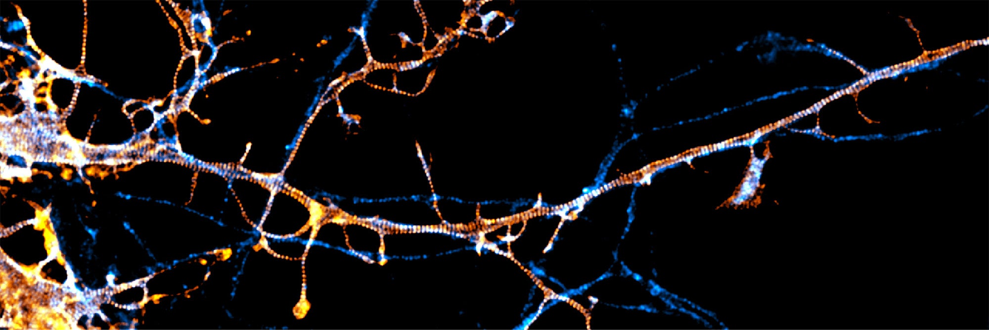 Specialized microscopy techniques have revealed that nerve cells have a special type of internal skeleton called the membrane-associated periodic skeleton. The well-ordered nanoarchitecture of this skeleton is regulated by a protein called paralemmin-1 (fluorescently labeled in this image).