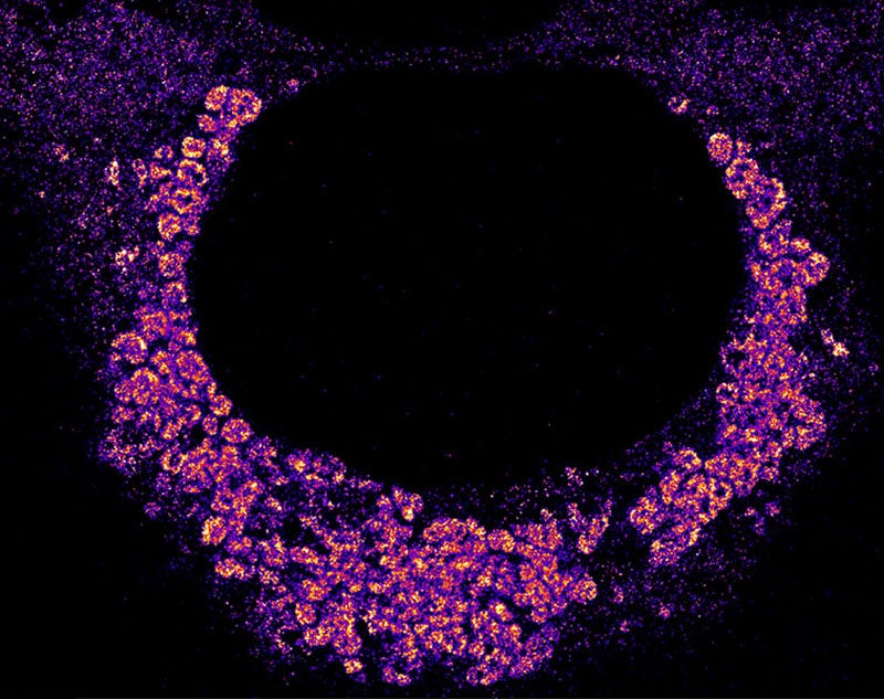 When the Covid-19 virus is being copied in human cells, it hides from the cell’s immune system by wrapping itself inside double-membrane bubbles, seen as clumpy aggregates of the virus’s fluorescently labeled genetic material. The cell’s nucleus appears as a dark circle in the middle.
