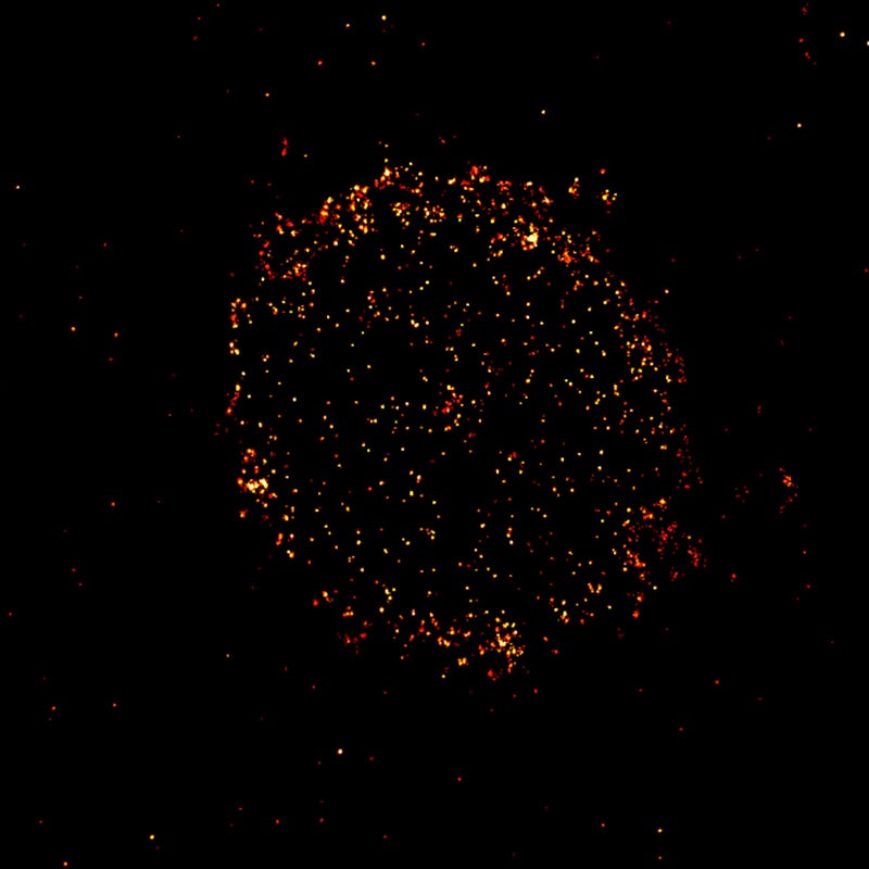 A new microscopy technique can light up the protein CD-19 on the surface of cancer cells. Detecting the protein, shown here on a cell from a patient with multiple myeloma, helps determine which patients could benefit from CD-19-targeting therapies.